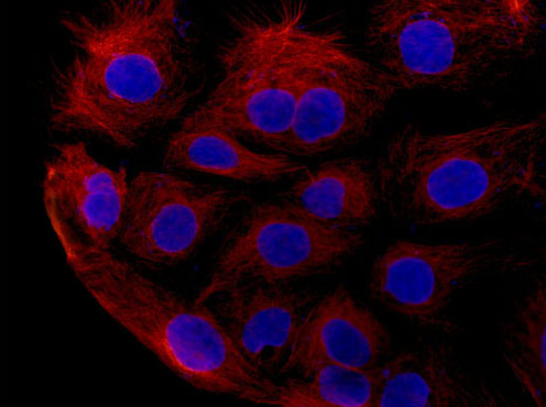 Immunofluorescent analysis of 4% paraformaldehyde-fixed Caco-2 cells labeling GAS8 with ab182580 at 1/500 dilution followed by Goat anti rabbit IgG (Alexa Fluor® 555) secondary antibody at 1/200 dilution. Counter stained with DAPI.