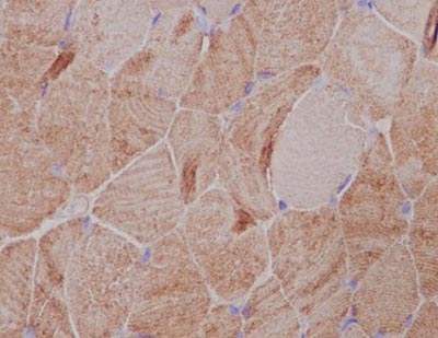 Immunohistochemical analysis of paraffin-embedded Human skeletal muscle tissue labeling GAS8 with ab182580 at 1/100 dilution followed by prediluted HRP Polymer for Rabbit IgG. Counter stained with Hematoxylin.