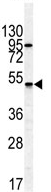 Anti-Gastric Inhibitory Polypeptide Receptor antibody - N-terminal (ab85180) at 1/50 dilution + HL60 cell line lysate at 35 µg