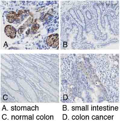 ab75044 staining Gastric Mucin in human stomach, small intestine and colon cancer tissue by Immunohistochemistry (Formalin/PFA-fixed paraffin-embedded sections). Tissue was fixed with formaldehyde and a heat mediated antigen retrieval step was performed using citrate buffer pH 6.0, 100°C for 20 minutes. Samples were then incubated with the primary antibody for 20 minutes at 25°C. A HRP-conjugated goat anti-mouse/rabbit polyclonal was used undiluted as the secondary antibody.See Abreview