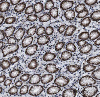 Image courtesy of Human Protein Atlasab22600 staining Gata6 in Human stomach, with strong staining within the glandular cells. Paraffin embedded human stomach was incubated with ab22600 (1/80 dilution) for 30 mins at room temperature. Antigen retrieval was performed by heat induction in citrate buffer pH 6.ab22600 was tested in a tissue microarray (TMA) containing a wide range of normal and cancer tissues as well as a cell microarray consisting of a range of commonly used, well characterised human cell lines. Further results for this antibody can be found at www.proteinatlas.org.