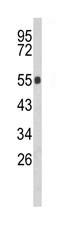 Anti-GBA antibody (ab175869) + Mouse Lung Lysate at 35 µgdeveloped using the ECL techniqueObserved band size : 56 kDa (why is the actual band size different from the predicted?)