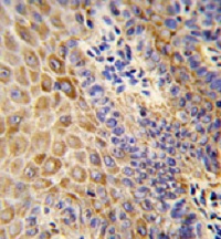 Immunohistochemistry (Formalin/PFA-fixed paraffin-embedded sections) analysis of human skin labelling GBA with ab175869. A peroxisae-conjugated anti-rabbit IgG was used as the secondary antibody, followed by DAB staining.