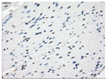 ab118031 at 1/50 dilution staining GBP2 in Paraffin-embedded Human Colon tissue by Immunohistochemistry.