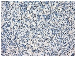 ab118031 at 1/50 dilution staining GBP2 in Paraffin-embedded Human Ovary tissue by Immunohistochemistry.