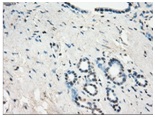 ab118031 at 1/50 dilution staining GBP2 in Paraffin-embedded Human Pancreas tissue by Immunohistochemistry.