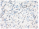 ab118031 at 1/50 dilution staining GBP2 in Paraffin-embedded Human Prostate tissue by Immunohistochemistry.