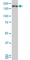 CrkRS antibody (ab57311) at 1ug/lane + HeLa cell lysate at 25ug/lane.