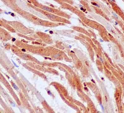 Immunohistochemical analysis of Human heart tissue, staining GCAT with ab181094 at 1/100 dilution. Detected using HRP Polymer for Rabbit IgG and counter-stained using hematoxylin.