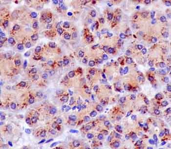 Immunohistochemical analysis of Human pancreas tissue, staining GCAT with ab181094 at 1/100 dilution. Detected using HRP Polymer for Rabbit IgG and counter-stained using hematoxylin.