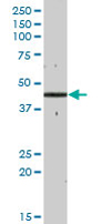Anti-GCDH antibody (ab67103) at 1/500 dilution + human liver tissue lysate at 25 µg/mlSecondaryGoat Anti-Mouse IgG (H&L)-HRP Conjugate at 1/2500 dilution