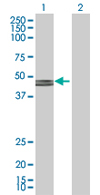 All lanes : Anti-GCDH antibody (ab67103) at 1/500 dilutionLane 1 : GCDH transfected 293T cell lysateLane 2 : Non-transfected 293T cell lysateLysates/proteins at 25 µg/ml per lane.SecondaryGoat Anti-Mouse IgG (H&L)-HRP Conjugate at 1/2500 dilution