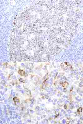 Ab68889 staining human GCET1 in human tonsil by immunohistochemistry using paraffin embedded tissue.