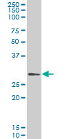 GCLM (ab55436) at 1ug/lane + HeLa cell lysate at 25ug/lane.