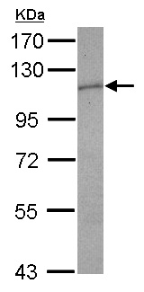 Anti-GCSF Receptor antibody (ab126167) at 1/1000 dilution + A431 whole cell lysate at 30 µg
