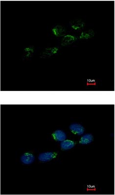 ab126167, at 1/500 dilution, staining GCSF Receptor in methanol-fixed A431 by Immunonfluorescence. The lower image is co-stained with Hoechst 33342.