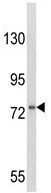 Anti-GCSF Receptor antibody (ab95114) at 1/100 dilution + HL-60 cell line lysate at 35 µg
