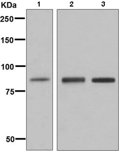 All lanes : Anti-GCSF Receptor antibody [EPR8957] (ab156878) at 1/1000 dilutionLane 1 : Human placenta extractLane 2 : NCCIT cell lysateLane 3 : Caco-2 cell lysateLysates/proteins at 10 µg per lane.developed using the ECL technique