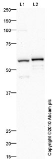 All lanes : Anti-CRLR antibody (ab84467) at 1 µg/mlLane 1 : Liver (Human) Tissue Lysate - adult normal tissue (ab29889)Lane 2 : A549 (Human lung adenocarcinoma epithelial cell line) Whole Cell Lysate Lysates/proteins at 10 µg per lane.SecondaryGoat polyclonal to Rabbit IgG - H&L - Pre-Adsorbed (HRP) at 1/3000 dilutiondeveloped using the ECL techniquePerformed under reducing conditions.