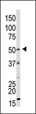 Anti-GDF 9 antibody (ab38544) at 1/100 dilution + HL60 cell lysate