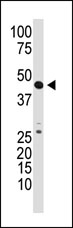 Anti-GDF3 antibody - Aminoterminal end (ab38547) at 1/100 dilution + Mouse kidney tissue lysate