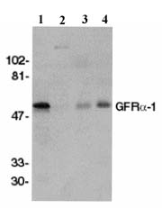 All lanes : Anti-GDNF Receptor alpha 1 antibody (ab8026) at 1/500 dilutionLane 1 : Crude membrane fractions of human brainLane 2 : Crude membrane fractions of liverLane 3 : Crude membrane fractions of kidneyLane 4 : Crude membrane fractions of spleen