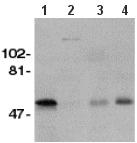 All lanes : Anti-GDNF Receptor alpha 1 antibody (ab62123) at 1/500 dilutionLane 1 : Crude membrane fraction of human brainLane 2 : Crude membrane fraction of human liverLane 3 : Crude membrane fraction of human kidneyLane 4 : Crude membrane fraction of human spleenLysates/proteins at 15 µg per lane.SecondaryAnti-rabbit IgG HRP