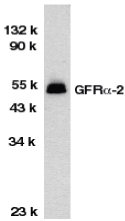 Anti-GDNF Receptor alpha 2 antibody (ab8027) at 1/1000 dilution + HeLa total cell lysateObserved band size : 52 kDa (why is the actual band size different from the predicted?)