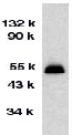 Anti-GDNF Receptor alpha 2 antibody (ab62124) at 1/1000 dilution + HeLa total cell lysate