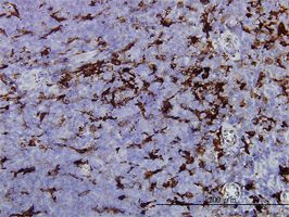 Gelsolin antibody (ab55070) used in immunohistochemistry at 1ug/ml on formalin fixed and paraffin embedded human adrenal gland.