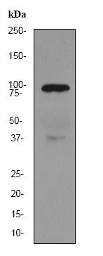 Anti-Gelsolin antibody [EPR1941Y] (ab75832) at 1/50000 dilution + human plasma at 10 µgSecondaryHRP labelled goat anti-rabbit at 1/2000 dilution