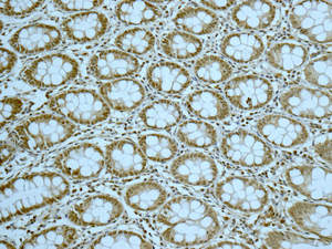 Immunohistochemical analysis of paraffin-embedded Human colon tissue labeling Gemin 3 with ab166913 at 1/100 dilution.