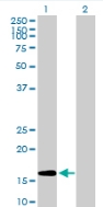 All lanes : Anti-Gemin 6 antibody (ab88290) at 1 µg/mlLane 1 : Gemin 6 transfected 293T cell lysate Lane 2 : Non-transfected 293T cell lysate Lysates/proteins at 50 µg per lane.SecondaryGoat Anti-Mouse IgG (H&L)-HRP Conjugate secondary antibody at 1/2500 dilution