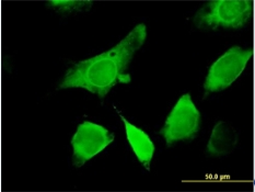 Immunofluorescence of ab88290 on HeLa cell with antibody concentration at 10ug/ml.