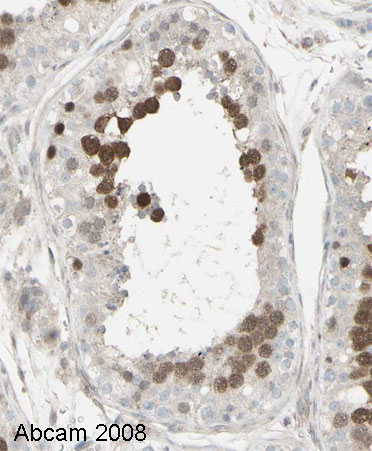 Image courtesy of Human Protein Atlas ab12147 staining in human testis, showing staining of the cells in the ductus seminiferus (in brown). Paraffin embedded testis tissue was incubated with ab12147 (1:175 dilution) for 30 mins at room temperature. Antigen retrieval was performed by heat induction in citrate buffer pH 6.ab12147 was tested in a tissue microarray (TMA) containing a wide range of normal and cancer tissues as well as a cell microarray consisting of a range of commonly used, well characterised human cell lines. Further results for this antibody can be found at www.proteinatlas.org.