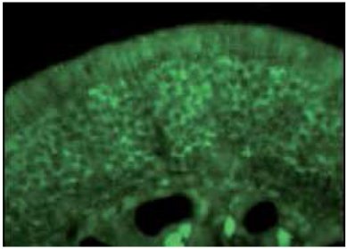 Ab36199 staining human CRMP1 in olfactory receptor neurons within the olfactory mucosa by immunohistochemistry.