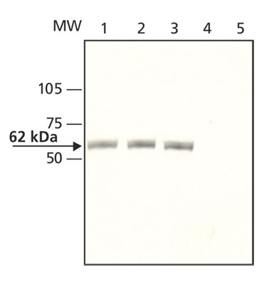 All lanes : Anti-CRMP1 antibody (ab62709) at 1/3000 dilutionLane 1 : Rat brain (S1 fraction)Lane 2 : Mouse brain (S1 fraction)Lane 3 : HEK-293T cells transfected with human CRMP1Lane 4 : Untransfected HEK-293T cellsLane 5 : Rat brain (S1 fraction) with CRMP1 immunizing peptide (10 µg/mL)