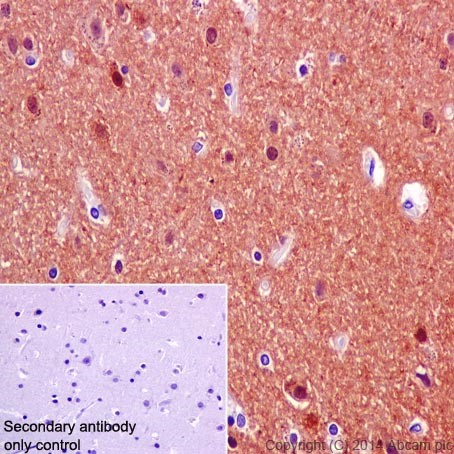 Immunohistochemical analysis of paraffin-embedded Human cerebral cortex tissue labeling CRMP1 with ab199722 at 1/8000 dilution, followed by Goat Anti-Rabbit IgG H&L (HRP) (ab97051) at 1/500 dilution. Cytoplasm and nucleus staining on Human cerebral cortex is observed. Counter stained with Hematoxylin.Secondary antibody only control: Used PBS instead of primary antibody, secondary antibody is Goat Anti-Rabbit IgG H&L (HRP) (ab97051) at 1/500 dilution.