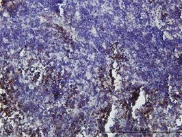 GFI1 antibody (ab55108) used in immunohistochemistry at 3ug/ml on formalin fixed and paraffin embedded human lymph node.