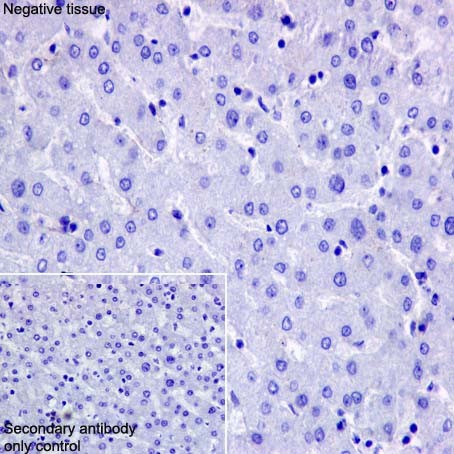 Immunohistochemical analysis of paraffin-embedded Human liver tissue labeling CRMP1 with ab199722 at 1/8000 dilution, followed by Goat Anti-Rabbit IgG H&L (HRP) (ab97051) at 1/500 dilution. No staining on Human liver tissue is observed. Counter stained with Hematoxylin.Secondary antibody only control: Used PBS instead of primary antibody, secondary antibody is Goat Anti-Rabbit IgG H&L (HRP) (ab97051) at 1/500 dilution.