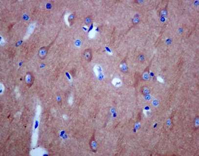Immunohistochemical analysis of paraffin-embedded Human brain tissue labeling CRMP1 with ab180517 at 1/500 dilution. Anti-rabbit HRP seconday antibody was used and counterstaining with Hematoxylin was performed.