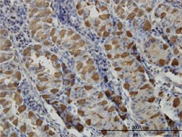 GGA1 antibody (ab57247) used in immunohistochemistry at 3ug/ml on formalin fixed and paraffin embedded human stomach.