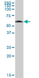 Anti-GGT6 antibody (ab70516) at 1/500 dilution + human spleen tissue lysate at 25 µgSecondaryGoat Anti-Mouse IgG (H&L)-HRP Conjugate at 1/2500 dilution