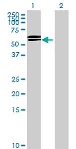 All lanes : Anti-GGT6 antibody (ab70516) at 1/500 dilutionLane 1 : GGT6 transfected 293T cell lysateLane 2 : Non-transfected 293T cell lysateLysates/proteins at 25 µg per lane.SecondaryGoat Anti-Mouse IgG (H&L)-HRP Conjugate at 1/2500 dilution
