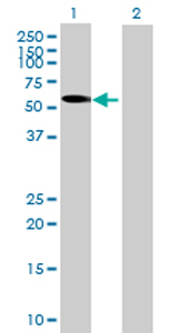 All lanes : Anti-GHDC antibody (ab69269) at 1/500 dilutionLane 1 : GHDC transfected 293T cell lysateLane 2 : Non-transfected 293T cell lysateLysates/proteins at 25 µg per lane.SecondaryGoat Anti-Mouse IgG (H&L)-HRP Conjugate at 1/2500 dilution
