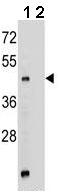 All lanes : Anti-Ghrelin O acyltransferase antibody (ab170690) at 1/100 dilutionLane 1 : Mouse stomach tissue lysateLane 2 : Mouse stomach tissue lysate with Blocking peptideLysates/proteins at 12.5 µg per lane.