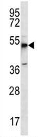 Anti-Ghrelin O acyltransferase antibody (ab170690) at 1/100 dilution + MCF7 cell line lysate at 35 µg
