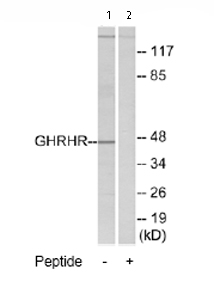 All lanes : Anti-GHRHR antibody (ab76263) at 1/500 dilutionLane 1 : Extracts from LOVO cellsLane 2 : Extracts from LOVO cells with immunizing peptide at 5 µgLysates/proteins at 5 µg per lane.
