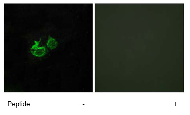 Immunofluorescence analysis of HUVEC cells using ab76263 at a 1/500 dilution.Left image un-treated.Right image treated with immunizing peptide.