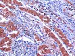 Ab5951 (10ug/ml) staining human GIPC1 in human kidney by immunohistochemistry using paraffin embedded tissue. Microwaved antigen retrieval with Tris/EDTA buffer pH9, HRP-staining.
